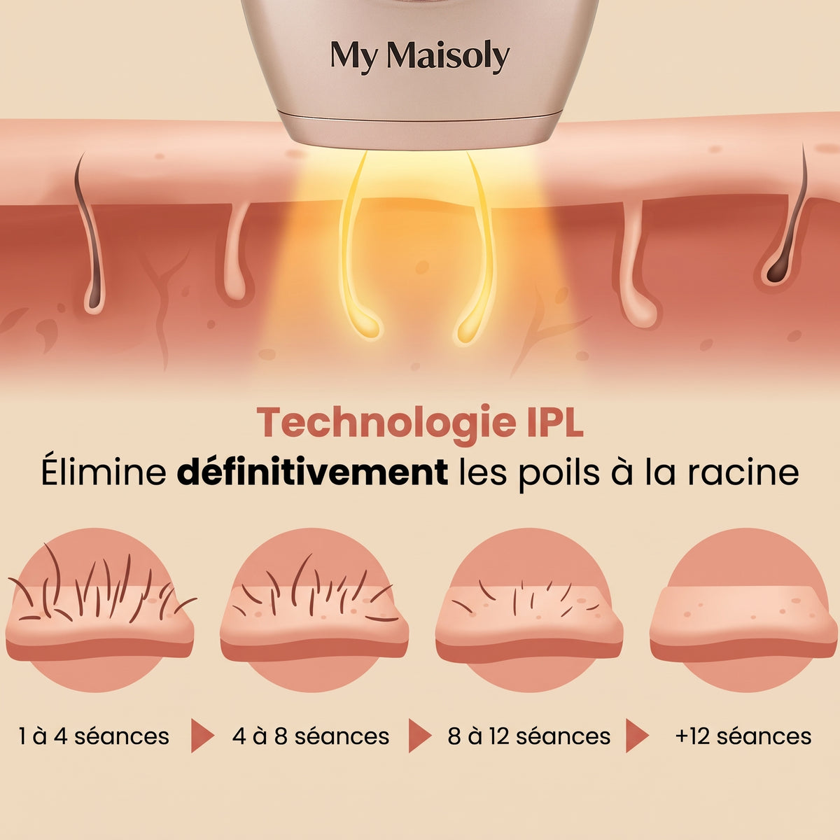 Épilateur IPL Indolore Mymaisoly